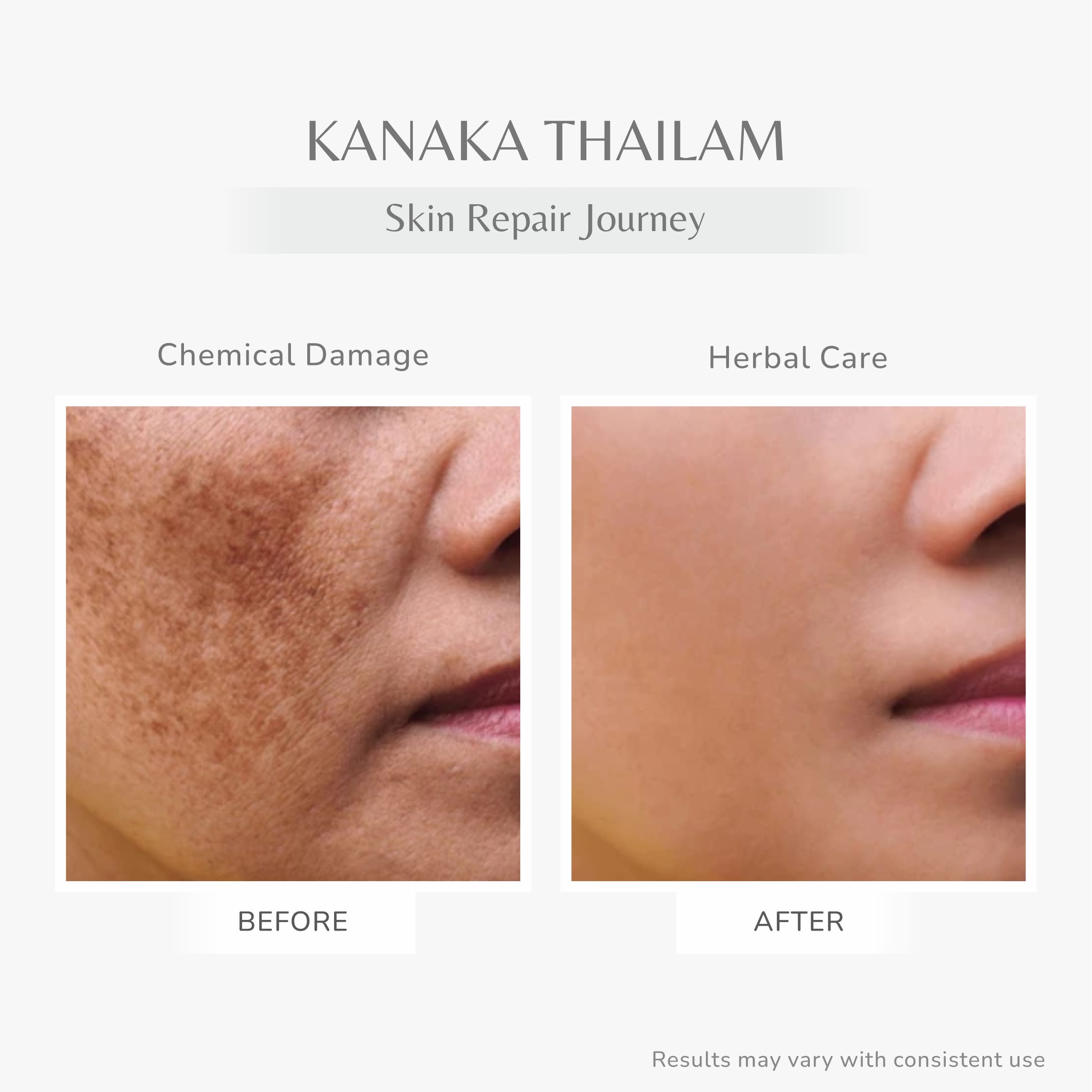 Jivantaherbal Kanaka Taila Ayurvedic Day Face Oil for Radiant Glow & Reduces Pigmentation